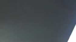 El primer hombre unicornio